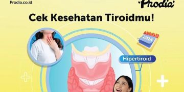 Gangguan Tiroid Dapat Ganggu Aktivitas